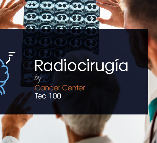 Radiocirugía