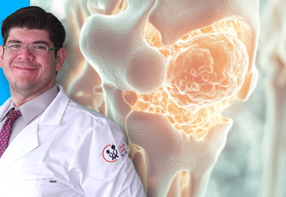 SARCOMAS Y OSTEOSARCOMAS