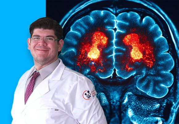 RADIOCIRUGÍA EN METÁSTASIS CEREBRAL