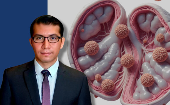 CÁNCER DE TESTÍCULO