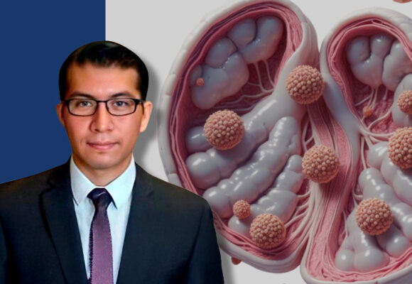 CÁNCER DE TESTÍCULO