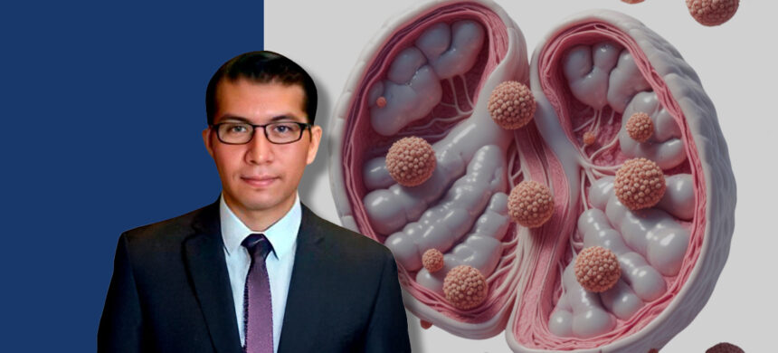 CÁNCER DE TESTÍCULO