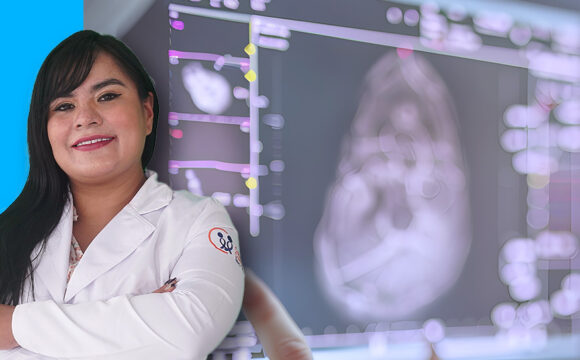 TOXICIDAD CUTÁNEA DE LA RADIOTERAPIA EN CÁNCER DE  MAMA Y SU IMPACTO EN LA CALIDAD DE VIDA