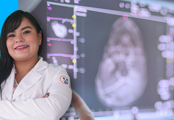 TOXICIDAD CUTÁNEA DE LA RADIOTERAPIA EN CÁNCER DE  MAMA Y SU IMPACTO EN LA CALIDAD DE VIDA