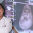 TOXICIDAD CUTÁNEA DE LA RADIOTERAPIA EN CÁNCER DE  MAMA Y SU IMPACTO EN LA CALIDAD DE VIDA