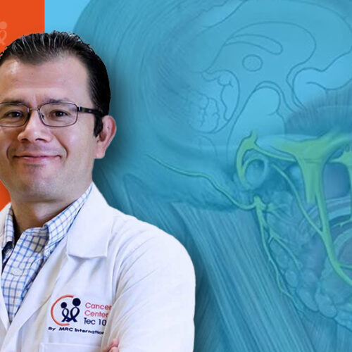 manuel RADIOCIRUGÍA EN NEURALGIA DEL TRIGÉMINO