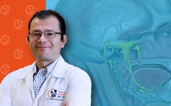 manuel RADIOCIRUGÍA EN NEURALGIA DEL TRIGÉMINO