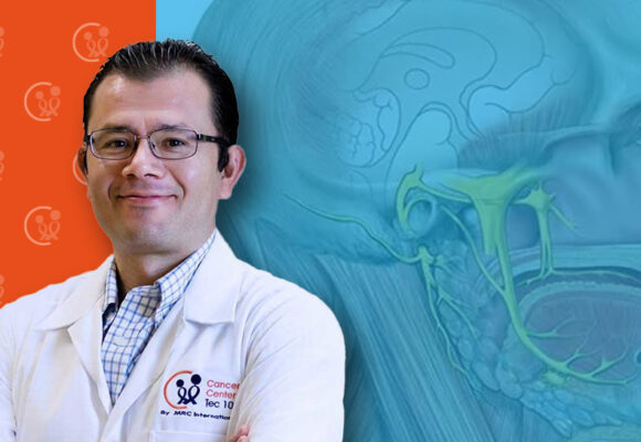 manuel RADIOCIRUGÍA EN NEURALGIA DEL TRIGÉMINO