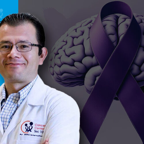 mario_dic EPILEPSIAS Y TRATAMIENTO DE RADIOCIRUGÍA