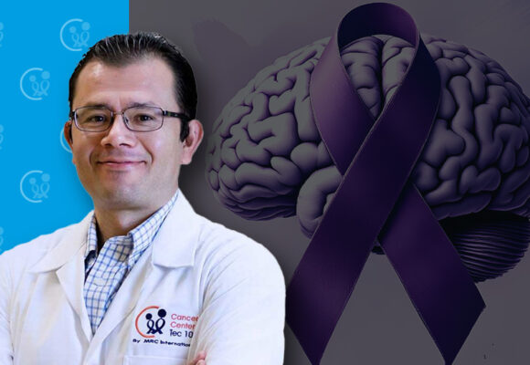 mario_dic EPILEPSIAS Y TRATAMIENTO DE RADIOCIRUGÍA