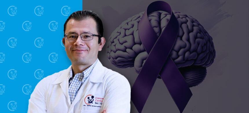 EPILEPSIAS Y TRATAMIENTO DE RADIOCIRUGÍA